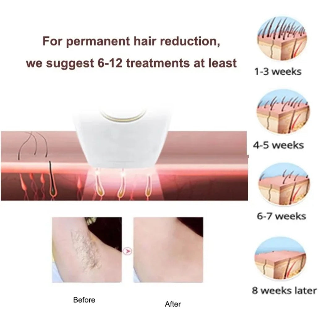 IPL Laser Hair Removal Handset System for Women & Men with Razor & Safety Glasses Pic 3